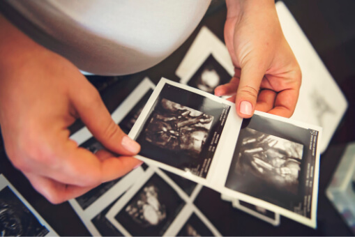 utjecaj vježbnaja na razvoj fetusa i porod